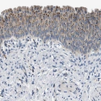 Anti-ADGRE3 Antibody