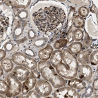 Immunohistochemical staining of human kidney shows strong granular cytoplasmic positivity in cells in tubules and in cells in glomeruli.