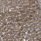Immunohistochemical staining of human liver shows strong granular cytoplasmic positivity in hepatocytes.