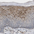 Immunohistochemical staining of human cervix strong granular cytoplasmic positivity in squamous epithelial cells.
