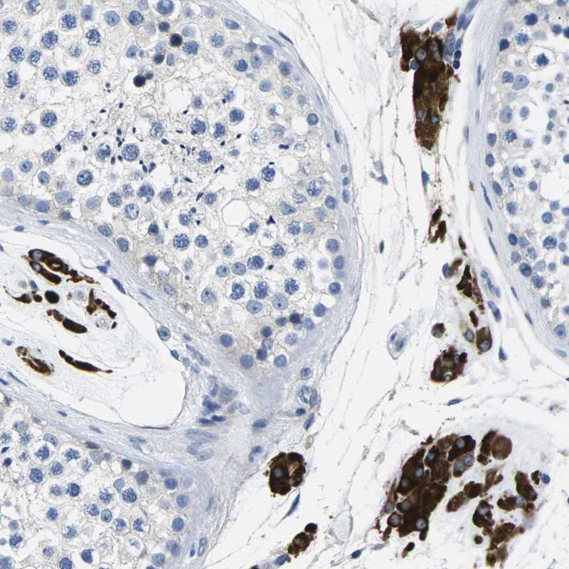 Anti-TSPAN2 Antibody