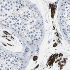 Anti-TSPAN2 Antibody