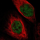 Immunofluorescent staining of human cell line A-431 shows localization to nucleoplasm.