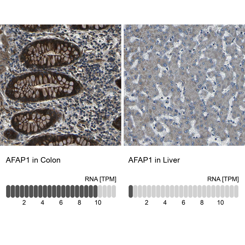 Anti-AFAP1 Antibody