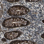 Immunohistochemical staining of human colon shows strong cytoplasmic positivity in glandular cells.