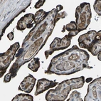 Immunohistochemical staining of human placenta shows strong granular cytoplasmic positivity in trophoblastic cells.