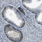 Immunohistochemical staining of human prostate shows moderate granular cytoplasmic positivity in glandular cells.