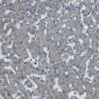 Immunohistochemical staining of human liver shows very weak positivity in hepatocytes as expected.