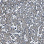 Immunohistochemical staining of human liver shows very weak positivity in hepatocytes as expected.