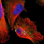 Immunofluorescent staining of human cell line U-251 MG shows positivity in cytoplasm, actin filaments & focal adhesion sites.
