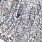 Immunohistochemical staining of human colon shows moderate cytoplasmic positivity in glandular cells.