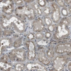Immunohistochemical staining of human kidney shows moderate cytoplasmic positivity in cells in tubules.