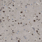 Immunohistochemical staining of human cerebral cortex shows moderate cytoplasmic positivity in neurons and endothelial cells.