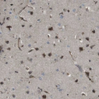 Immunohistochemical staining of human cerebral cortex shows moderate cytoplasmic positivity in neurons and endothelial cells.