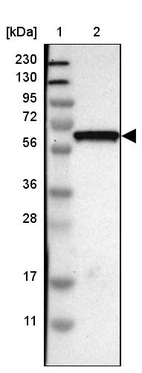 Lane 1: Marker [kDa] 230, 130, 95, 72, 56, 36, 28, 17, 11_br/_Lane 2: Human cell line RT-4