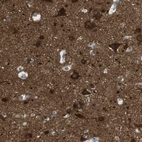 Immunohistochemical staining of human cerebral cortex shows strong cytoplasmic positivity in neurons.