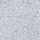 Immunohistochemical staining of human liver shows no positivity in hepatocytes as expected.