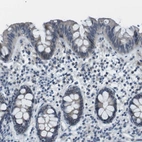 Immunohistochemical staining of human colon shows no positivity in glandular cells as expected.