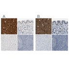 Anti-RTN3 Antibody