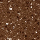 Immunohistochemical staining of human cerebral cortex shows strong cytoplasmic positivity in neurons.