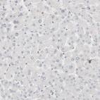 Immunohistochemical staining of human liver shows no positivity in hepatocytes as expected.