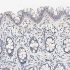Immunohistochemical staining of human colon shows no positivity in glandular cells as expected.