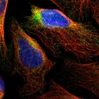Immunofluorescent staining of human cell line U-2 OS shows localization to endoplasmic reticulum.