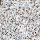 Immunohistochemical staining of human placenta shows high expression.