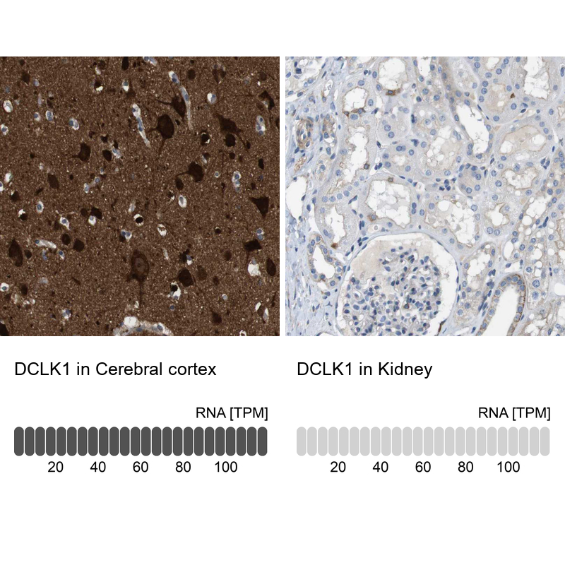 Anti-DCLK1 Antibody