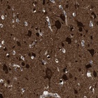 Immunohistochemical staining of human cerebral cortex shows high expression.