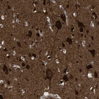 Immunohistochemical staining of human cerebral cortex shows high expression.