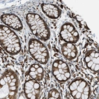 Immunohistochemical staining of human colon shows strong membranous and cytoplasmic positivity in glandular cells.