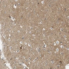 Immunohistochemical staining of human cerebral cortex shows moderate membranous and cytoplasmic positivity in neuropil.