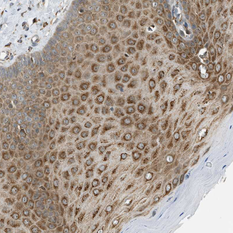 Rabbit Polyclonal AntiSEMA4D Antibody Buy for research Highly