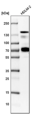 Western blot analysis in human cell line HDLM-2.