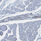 Immunohistochemical staining of human skeletal muscle shows no positivity in myocytes as expected.