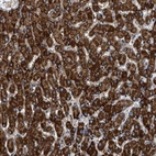 Anti-KCNMB3 Antibody