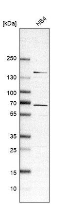 Western blot analysis in human cell line NB4.