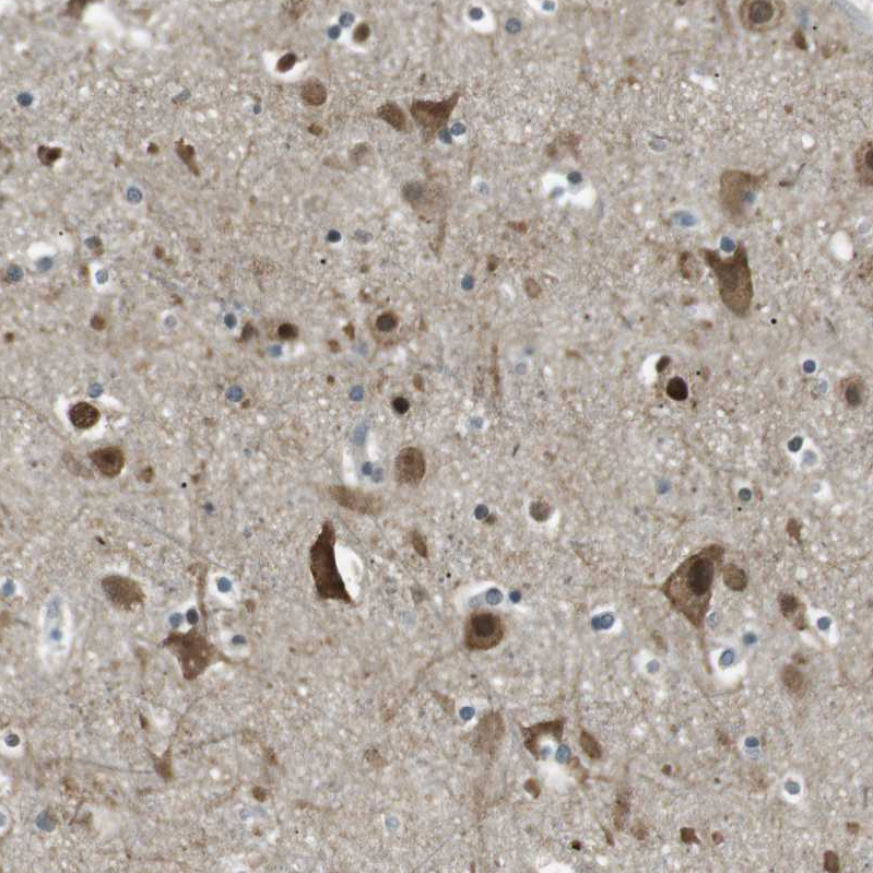 Anti-TMEM74 Antibody