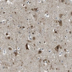 Anti-TMEM74 Antibody