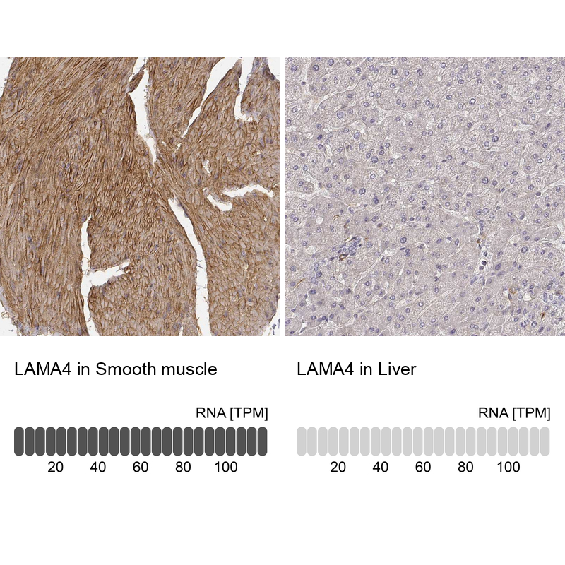 Anti-LAMA4 Antibody