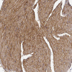 Immunohistochemical staining of human smooth muscle shows strong cytoplasmic positivity in smooth muscle cells.