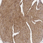 Immunohistochemical staining of human smooth muscle shows strong cytoplasmic positivity in smooth muscle cells.