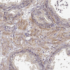Immunohistochemical staining of human prostate shows moderate cytoplasmic positivity in smooth muscle cells.