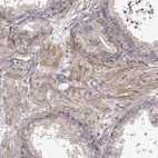 Immunohistochemical staining of human prostate shows moderate cytoplasmic positivity in smooth muscle cells.