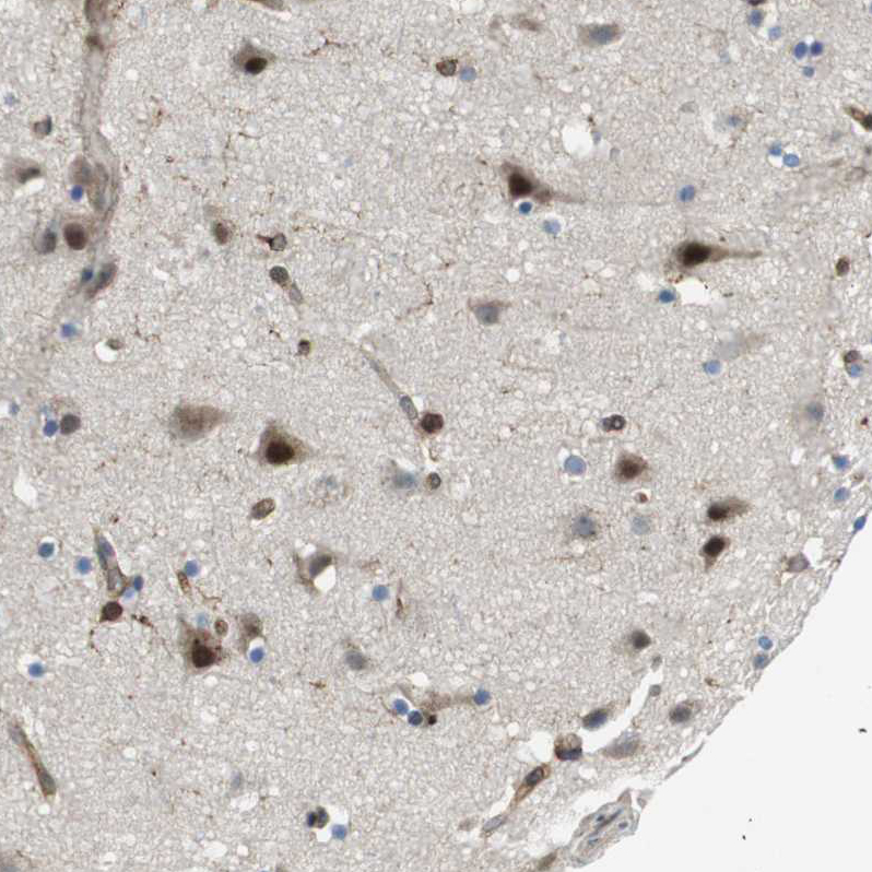Anti-PALD1 Antibody