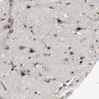 Anti-PALD1 Antibody