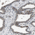 Immunohistochemical staining of human prostate shows moderate cytoplasmic positivity in glandular cells.