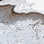 Immunohistochemical staining of human skin shows moderate cytoplasmic/membranous positivity in squamous epithelial cells.