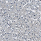 Immunohistochemical staining of human liver shows low positivity in hepatocytes as expected.